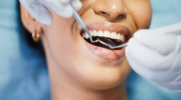 Best Emergency Dental Care for Broken or Chipped Teeth in La Grulla, TX